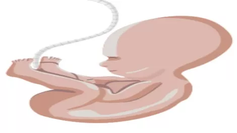 Nurture your IT baby