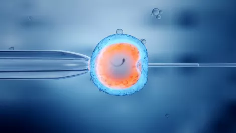 Engender: Laser guided sperm