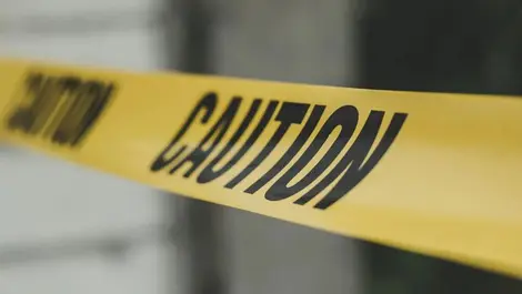 Unsafe machine costs worker his arm